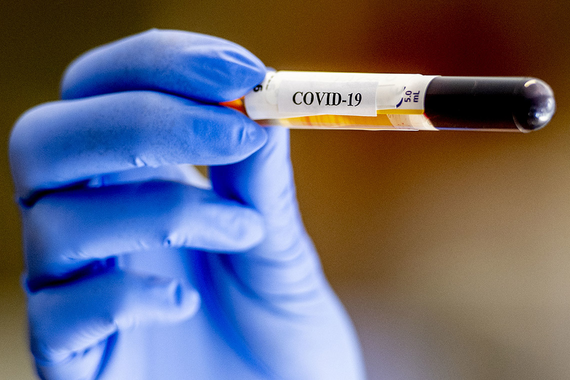 A lab technician holding a test tube that contains blood