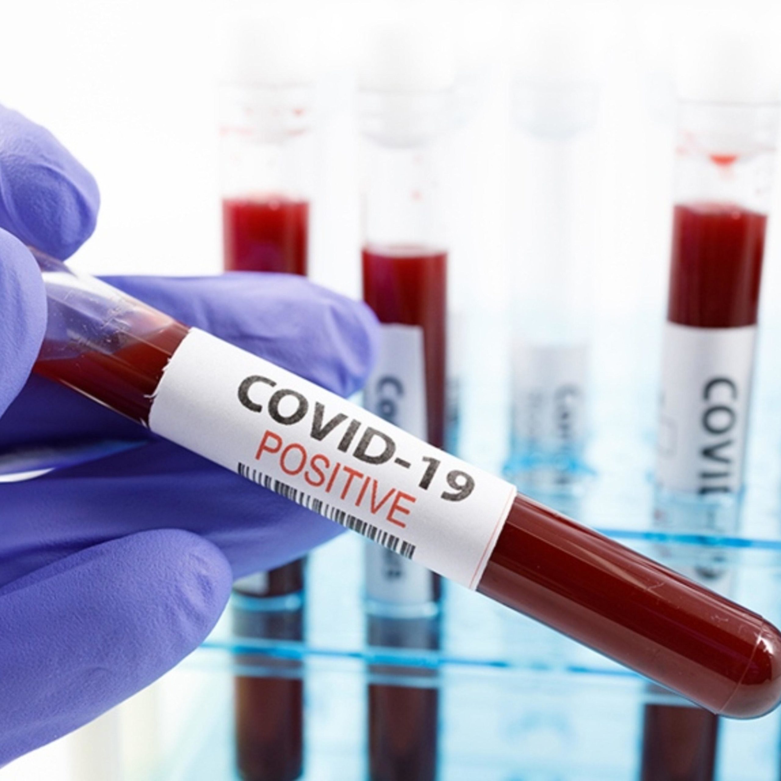 COVID-19 positive test tube