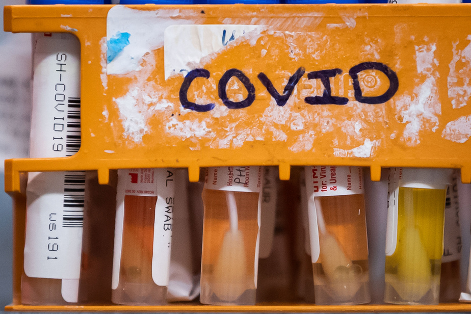 COVID test tubes